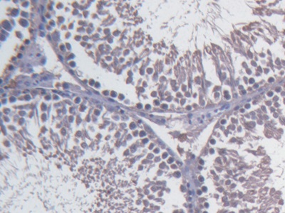 Monoclonal Antibody to Fibulin 1 (FBLN1)