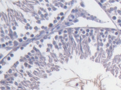 Monoclonal Antibody to Fibulin 1 (FBLN1)