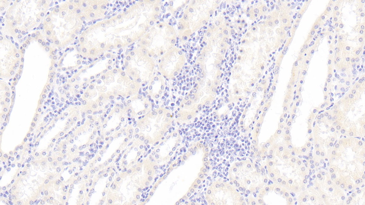 Monoclonal Antibody to Histidine Rich Glycoprotein (HRG)