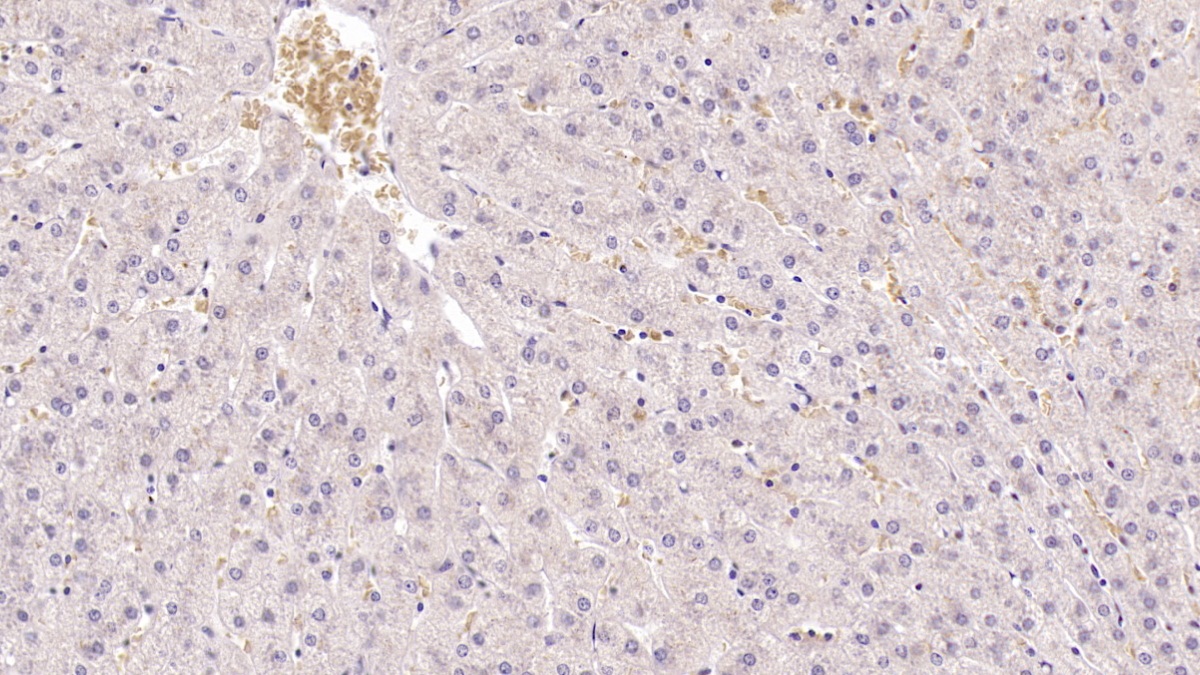 Monoclonal Antibody to Histidine Rich Glycoprotein (HRG)