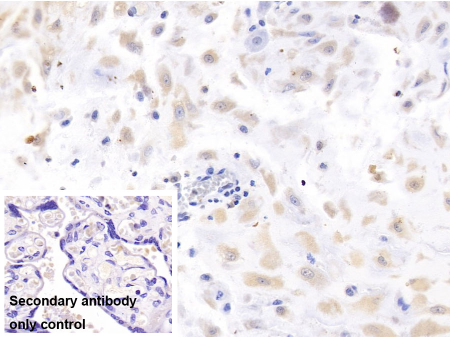 Monoclonal Antibody to Luteinizing Hormone Beta Polypeptide (LHb)