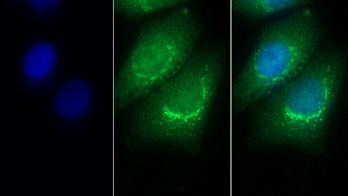 Monoclonal Antibody to Prosaposin (PSAP)