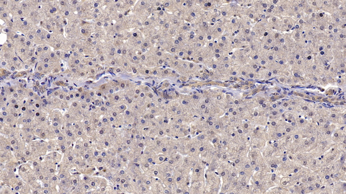 Monoclonal Antibody to Reelin (RELN)