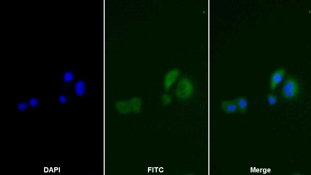 Monoclonal Antibody to Thymidine Kinase 1, Soluble (TK1)