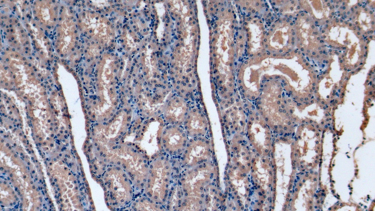 Monoclonal Antibody to Stanniocalcin 1 (STC1)