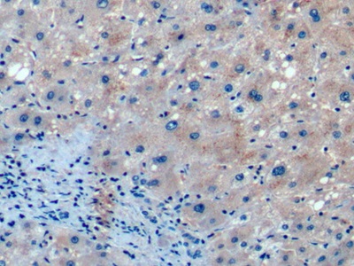 Monoclonal Antibody to Fibroblast Growth Factor 21 (FGF21)