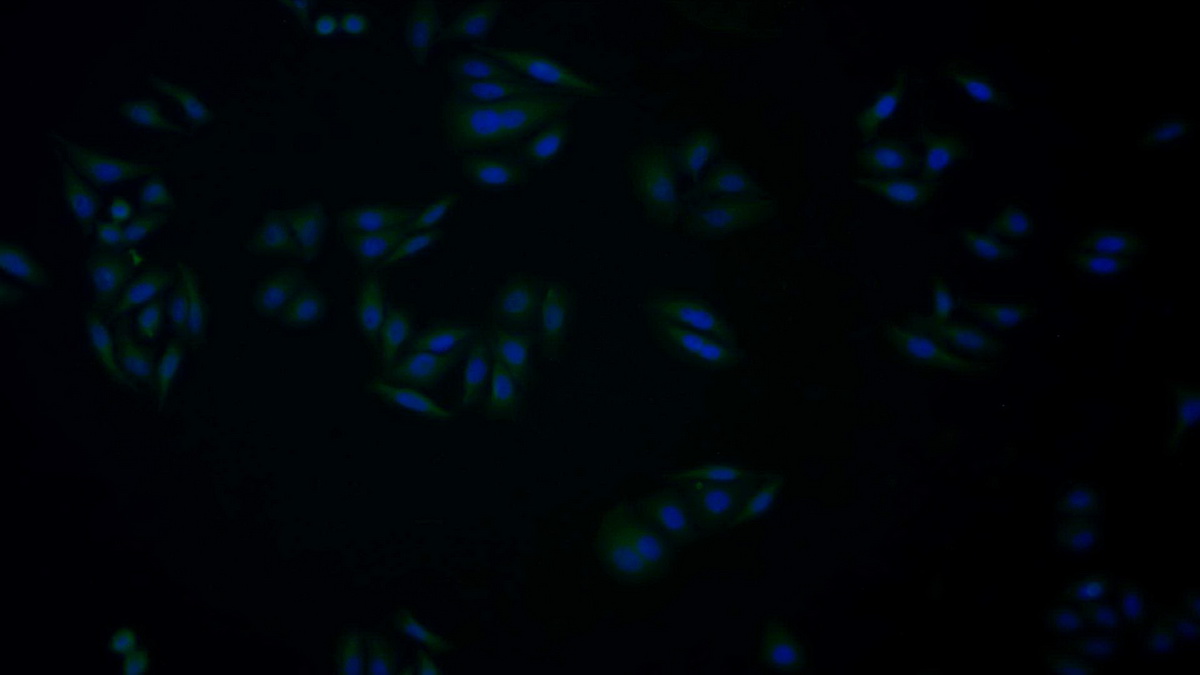 Monoclonal Antibody to Arginyl tRNA Synthetase (RARS)