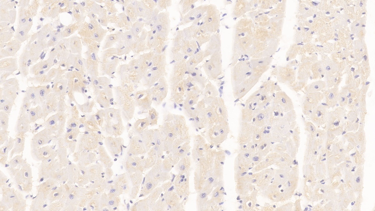 Monoclonal Antibody to Arginyl tRNA Synthetase (RARS)