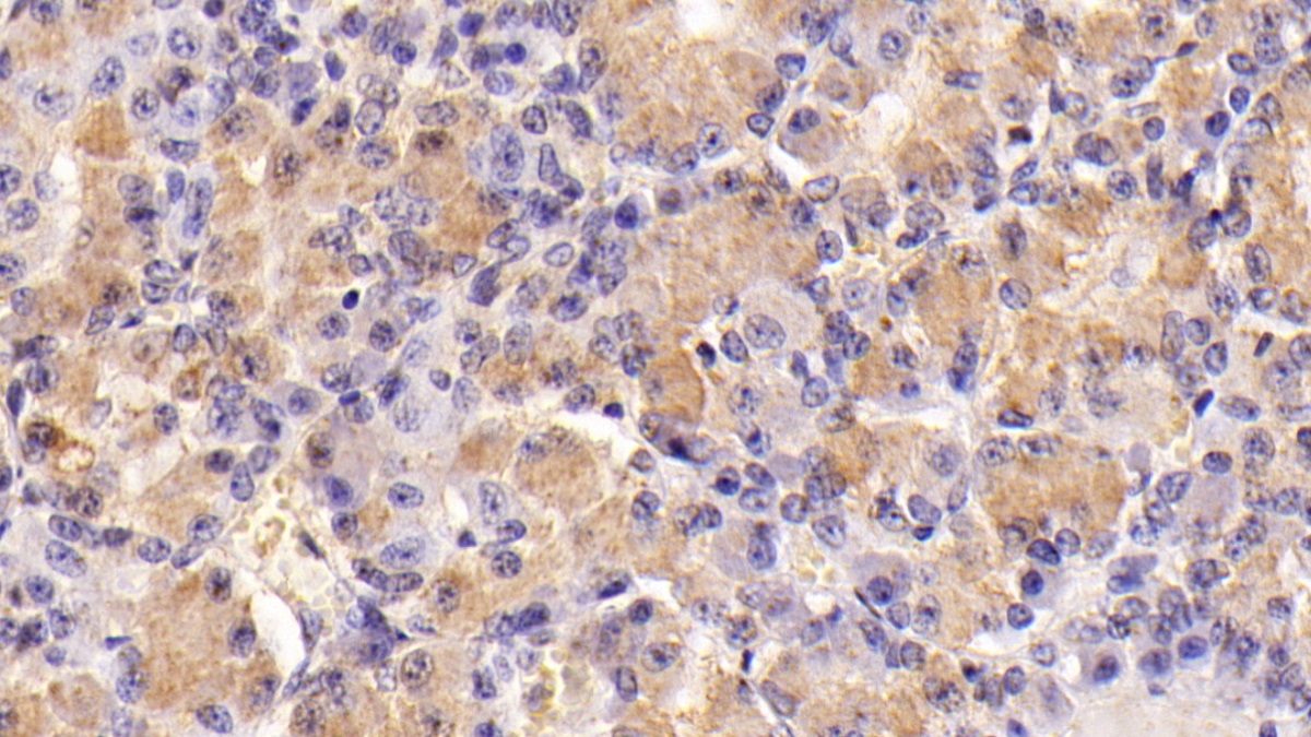 Monoclonal Antibody to Follicle Stimulating Hormone Beta (FSHb)