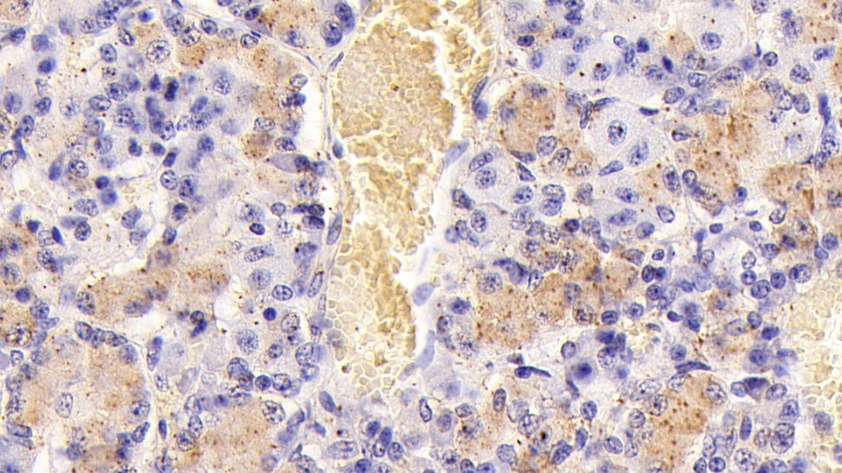 Monoclonal Antibody to Follicle Stimulating Hormone Beta (FSHb)