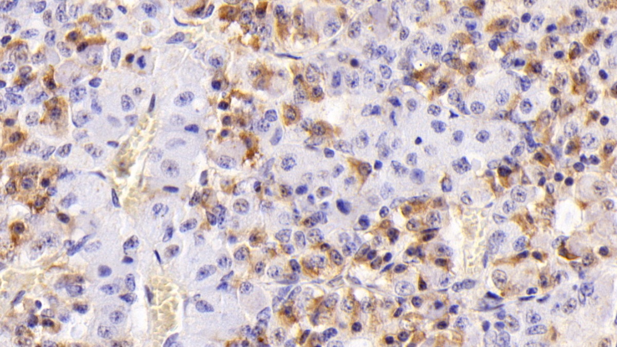 Monoclonal Antibody to Follicle Stimulating Hormone Beta (FSHb)