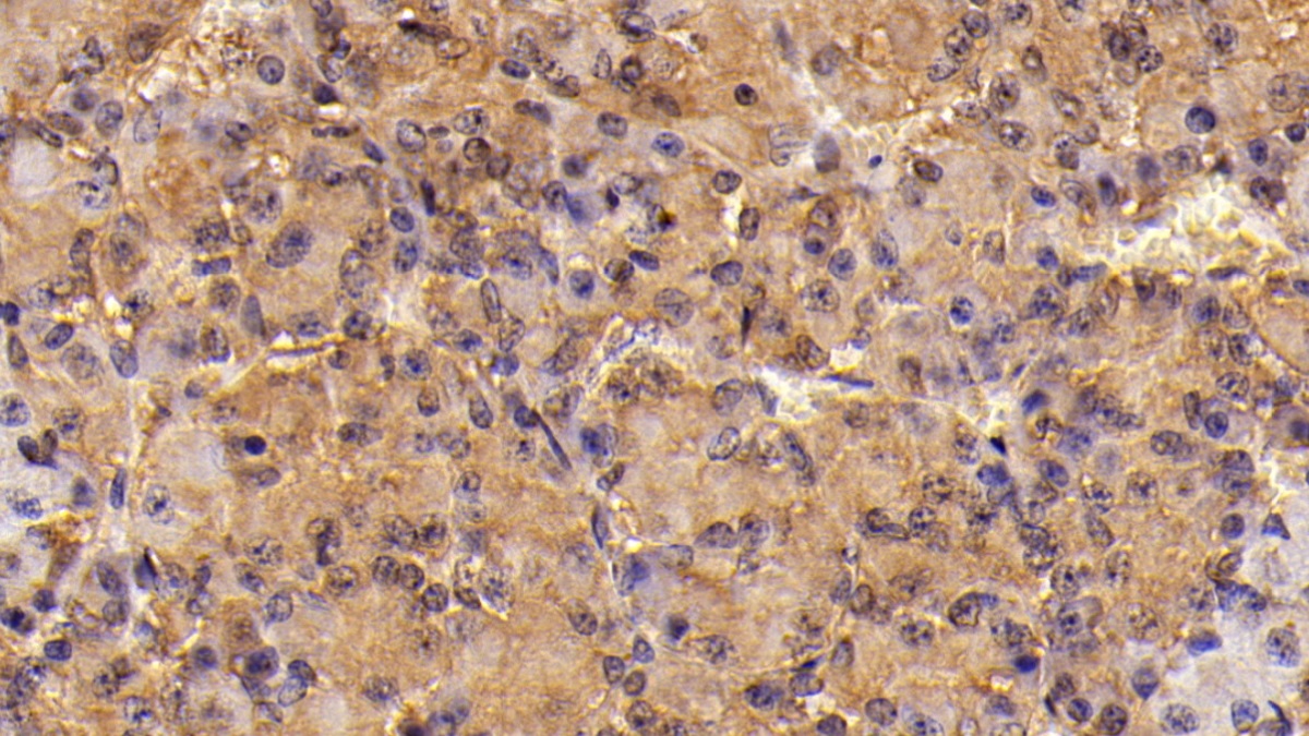 Monoclonal Antibody to Follicle Stimulating Hormone Beta (FSHb)