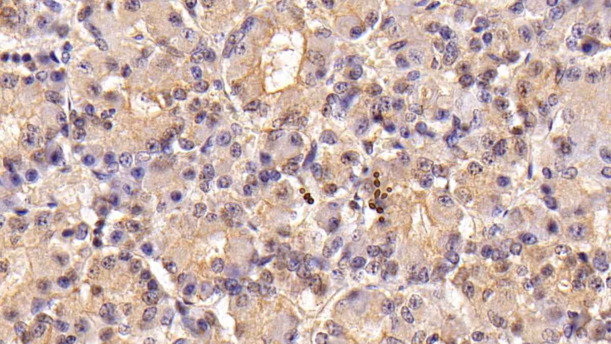 Monoclonal Antibody to Follicle Stimulating Hormone Beta (FSHb)