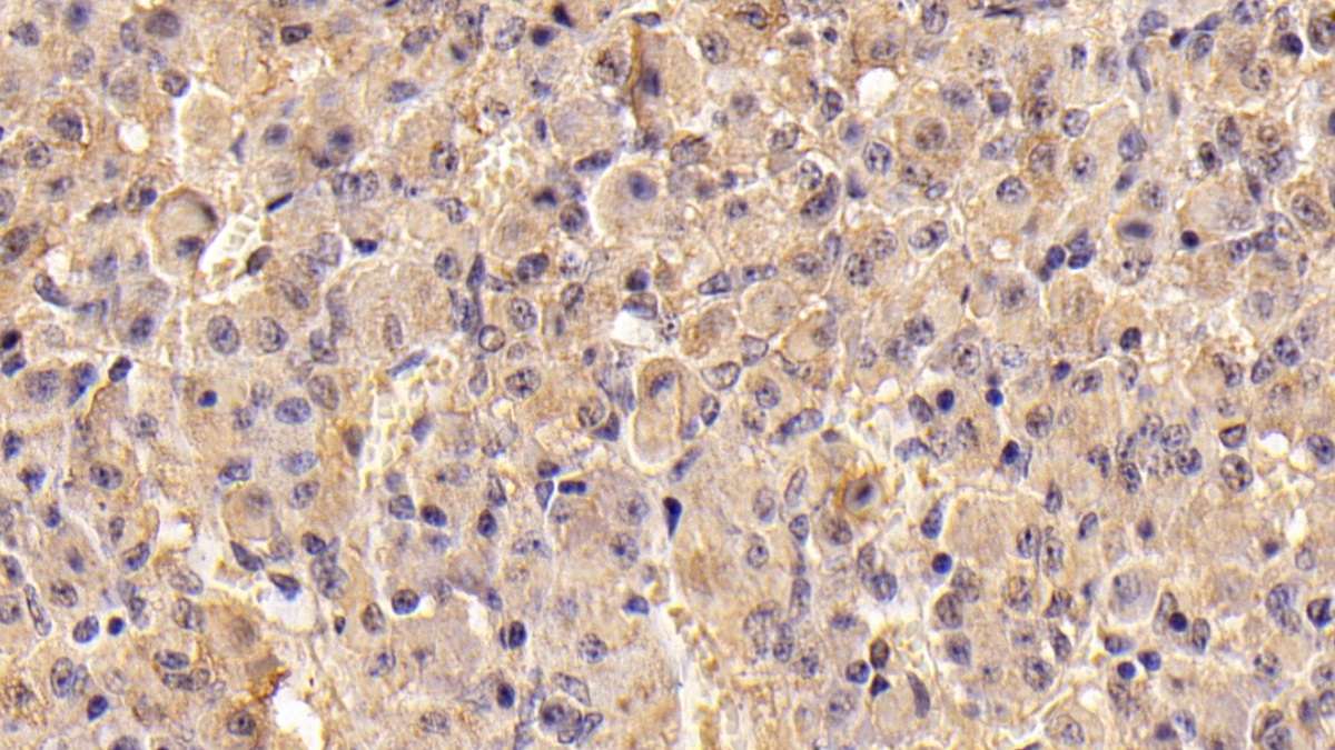 Monoclonal Antibody to Follicle Stimulating Hormone Beta (FSHb)