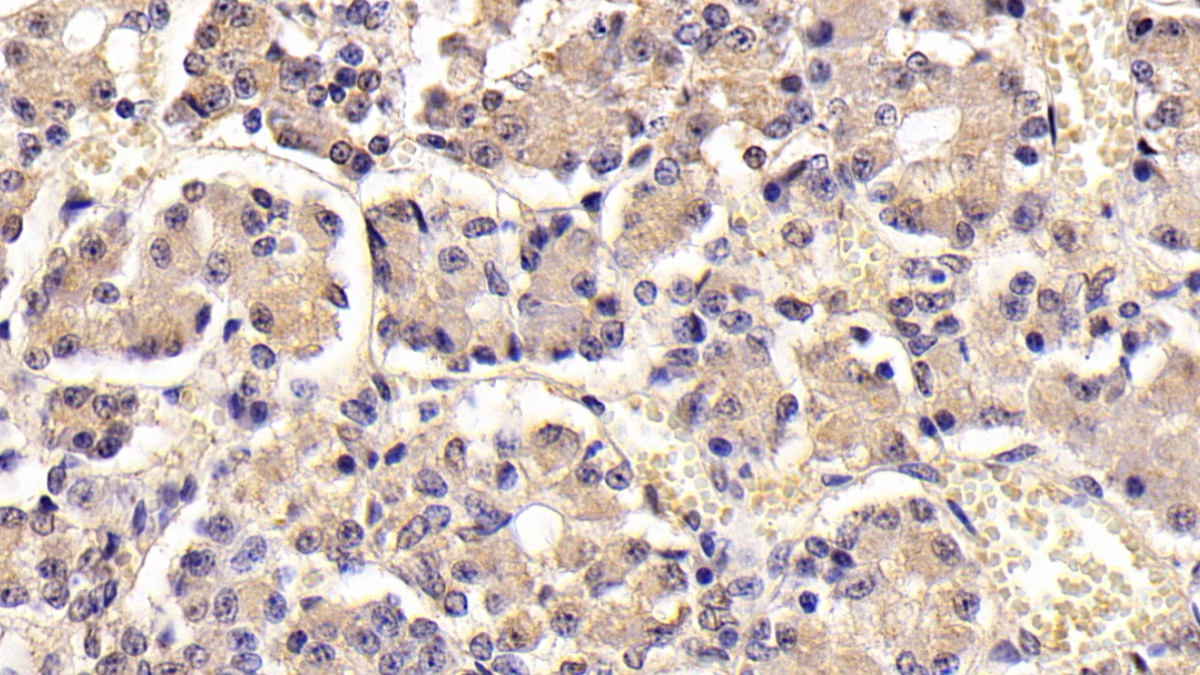 Monoclonal Antibody to Follicle Stimulating Hormone Beta (FSHb)