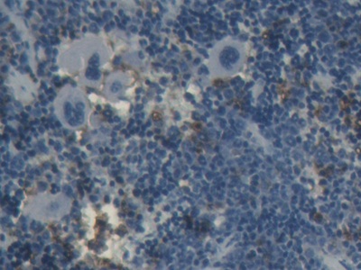 Monoclonal Antibody to Ferritin, Heavy Polypeptide (FTH)