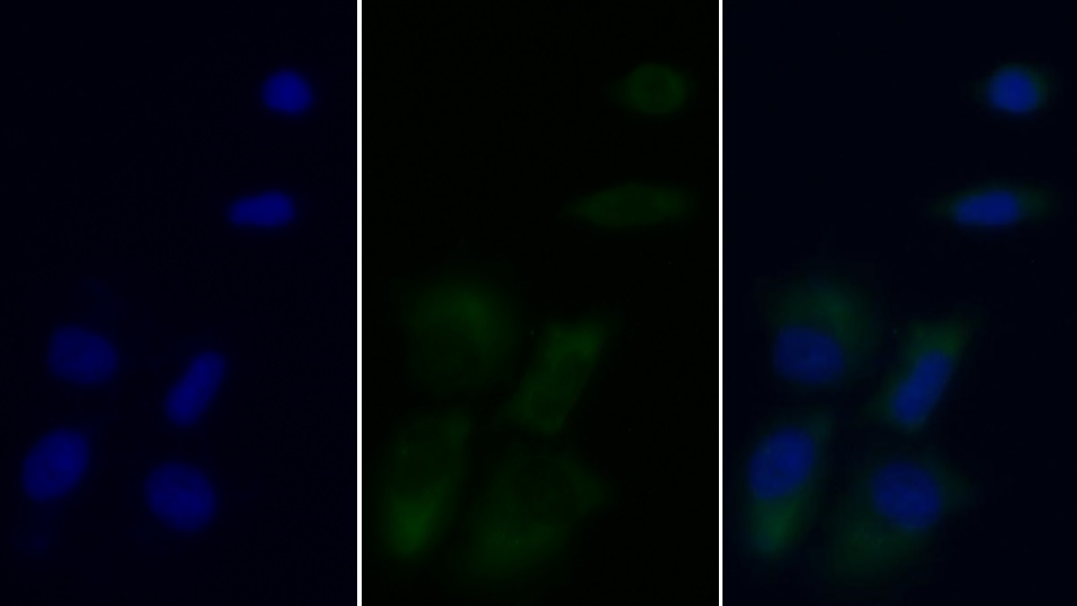 Monoclonal Antibody to Ferritin, Heavy Polypeptide (FTH)