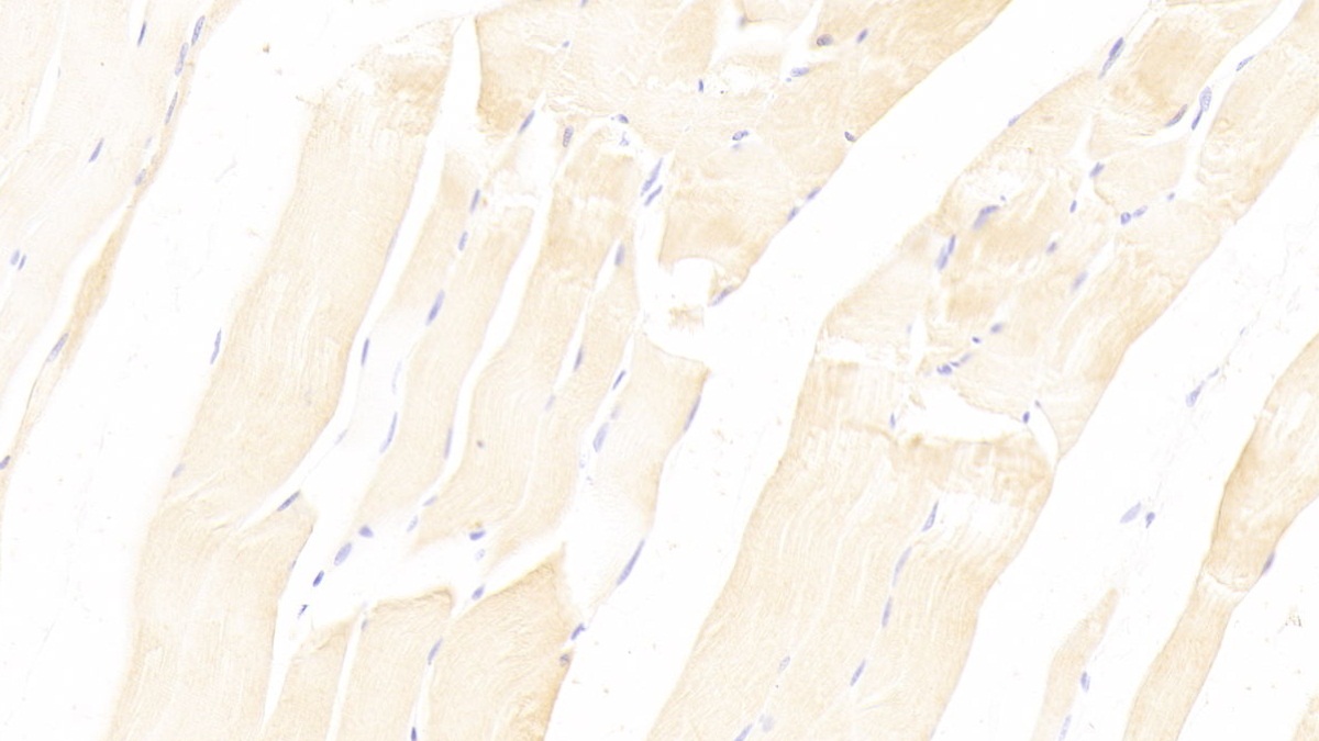 Monoclonal Antibody to Neuropilin 2 (NRP2)