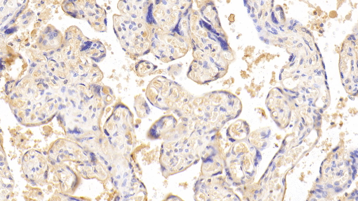 Monoclonal Antibody to Chorionic Gonadotropin Beta Polypeptide (CGb)