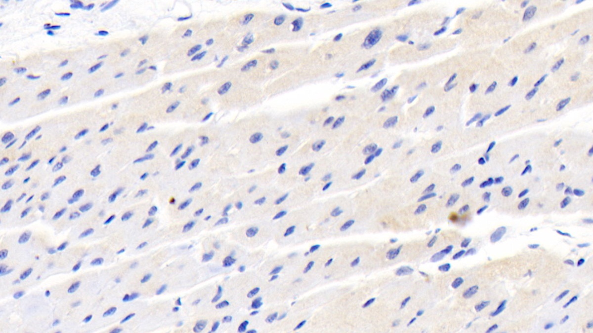 Monoclonal Antibody to Diazepam Binding Inhibitor (DBI)