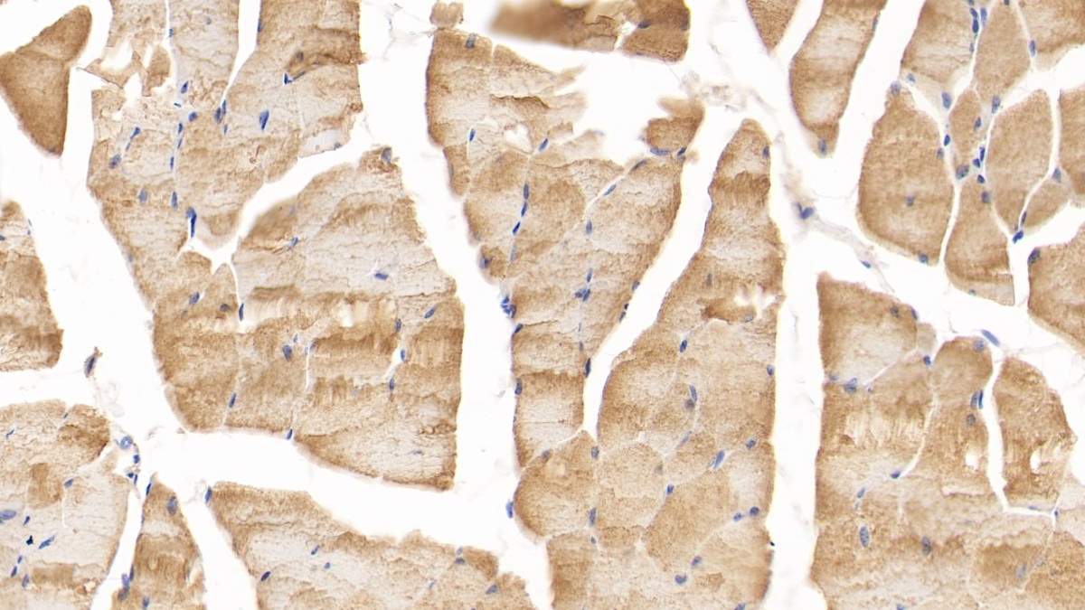 Monoclonal Antibody to Deoxythymidylate Kinase (DTYMK)