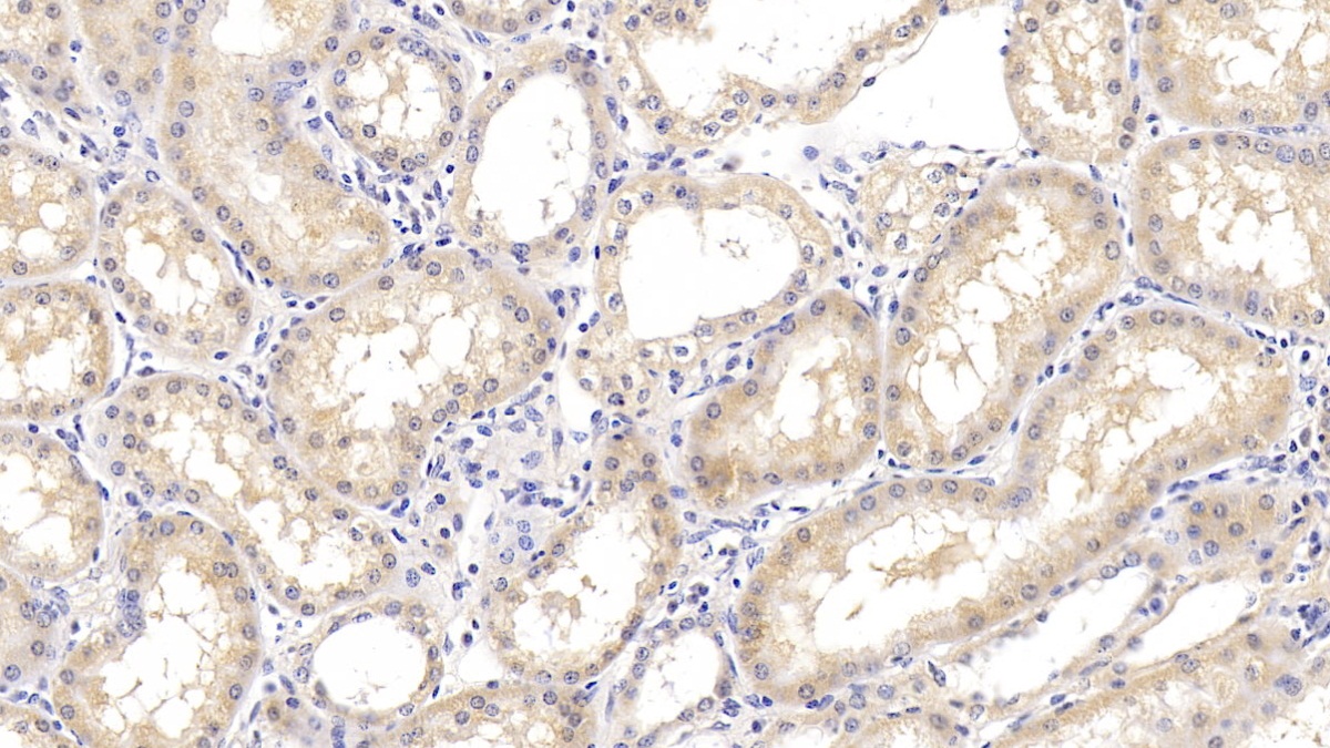 Monoclonal Antibody to Arginase II (Arg2)