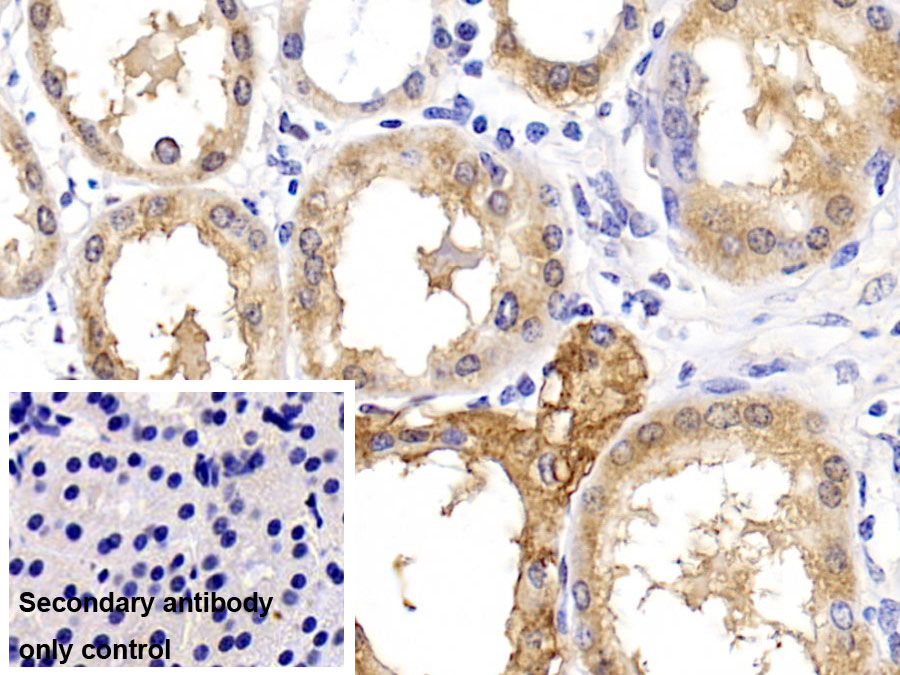 Monoclonal Antibody to Arginase II (Arg2)