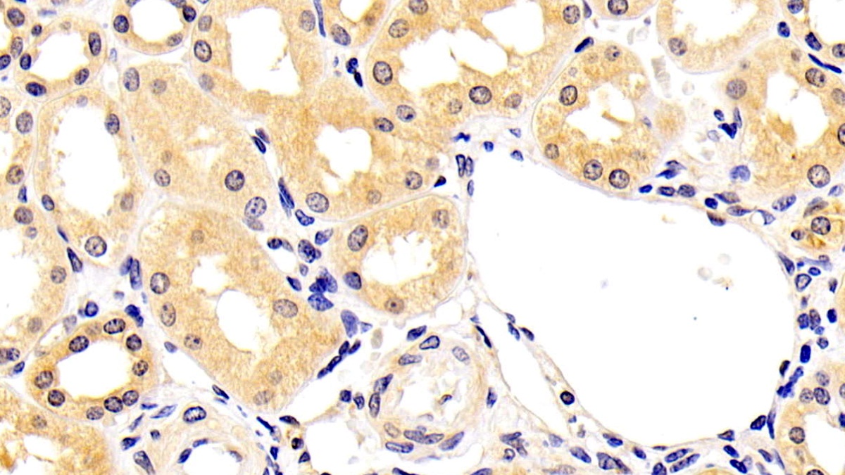 Monoclonal Antibody to Neurofilament, Light Polypeptide (NEFL)