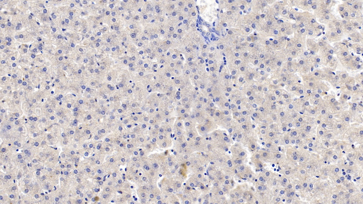 Monoclonal Antibody to Tryptophan-2,3-dioxygenase (TDO)