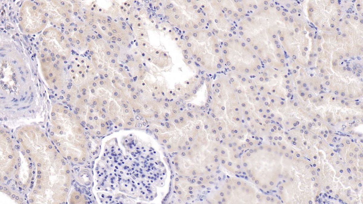 Monoclonal Antibody to Tryptophan-2,3-dioxygenase (TDO)