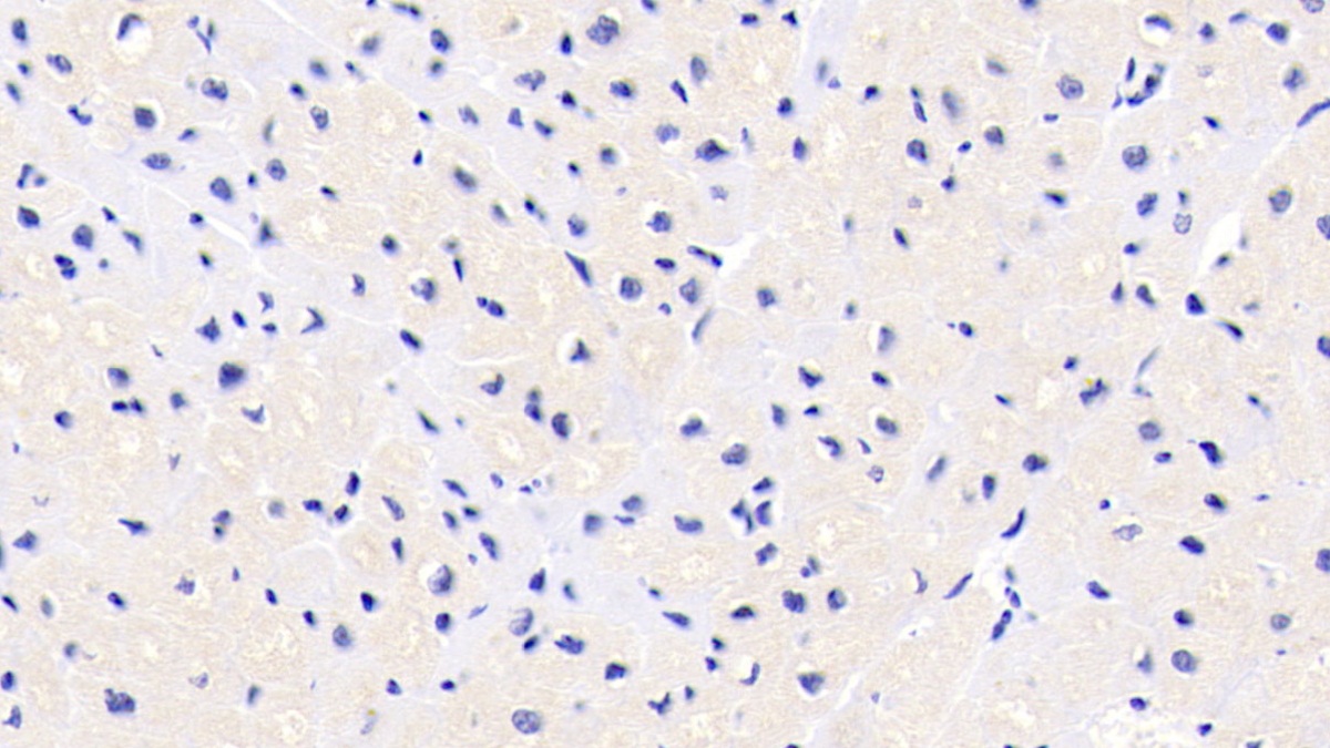 Monoclonal Antibody to FK506 Binding Protein 1A (FKBP1A)