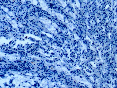 Monoclonal Antibody to Annexin A1 (ANXA1)