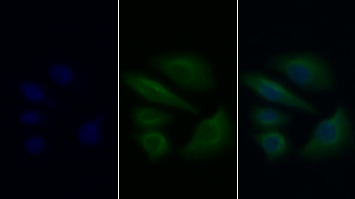 Monoclonal Antibody to Annexin A1 (ANXA1)