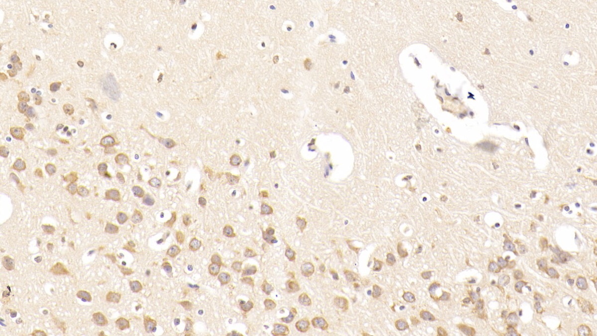 Monoclonal Antibody to Glutamate Receptor, Ionotropic, N-Methyl-D-Aspartate 2B (GRIN2B)