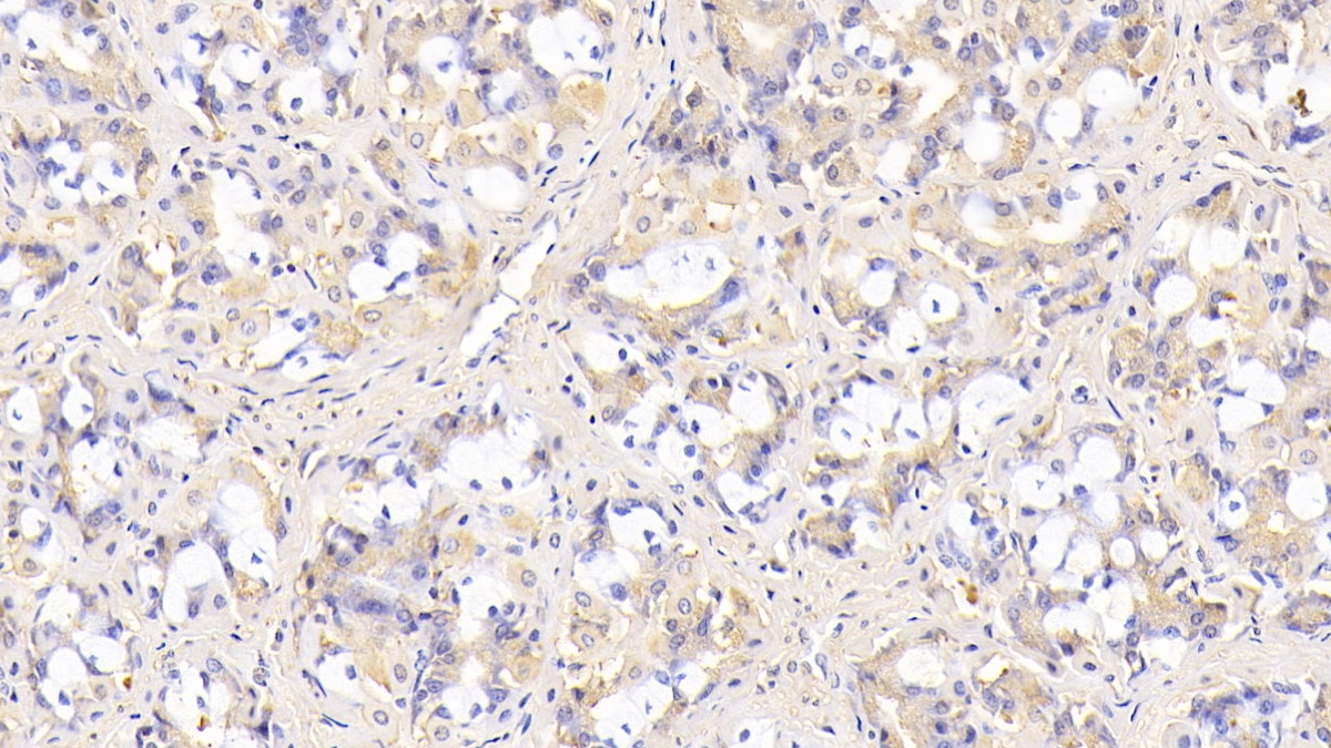 Monoclonal Antibody to Sirtuin 3 (SIRT3)