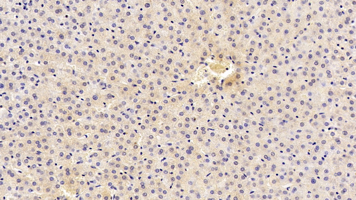 Monoclonal Antibody to Anthrax Toxin Receptor 2 (ANTXR2)