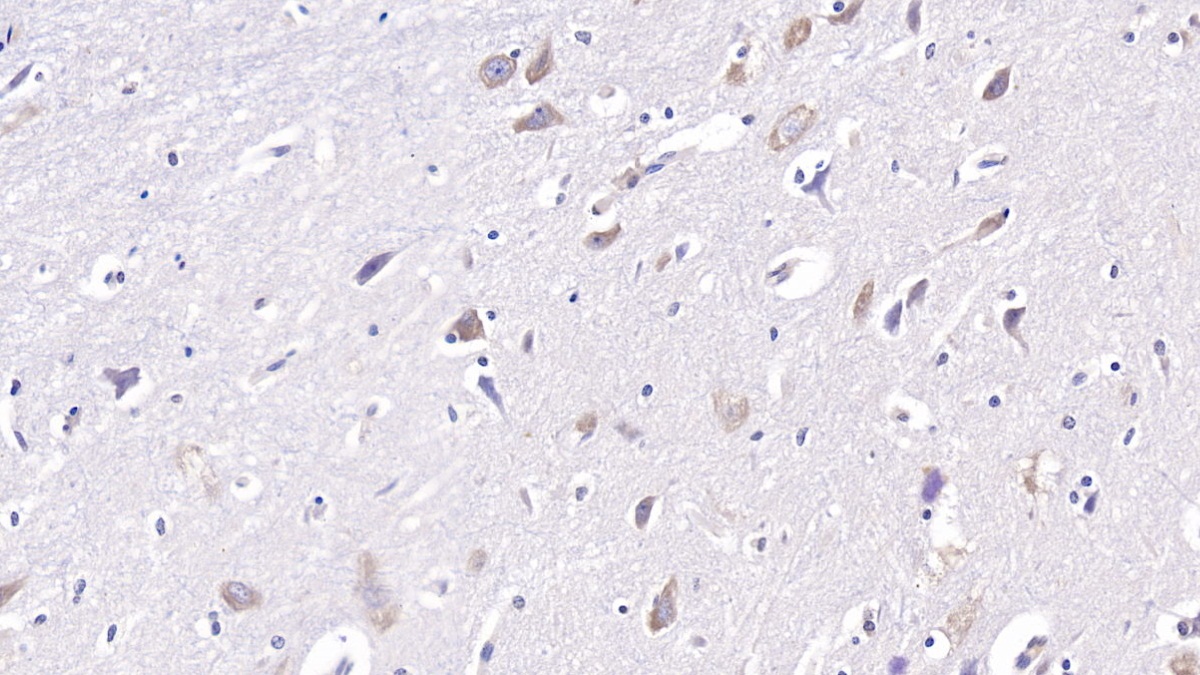 Monoclonal Antibody to Doublecortin Like Kinase 1 (DCLK1)