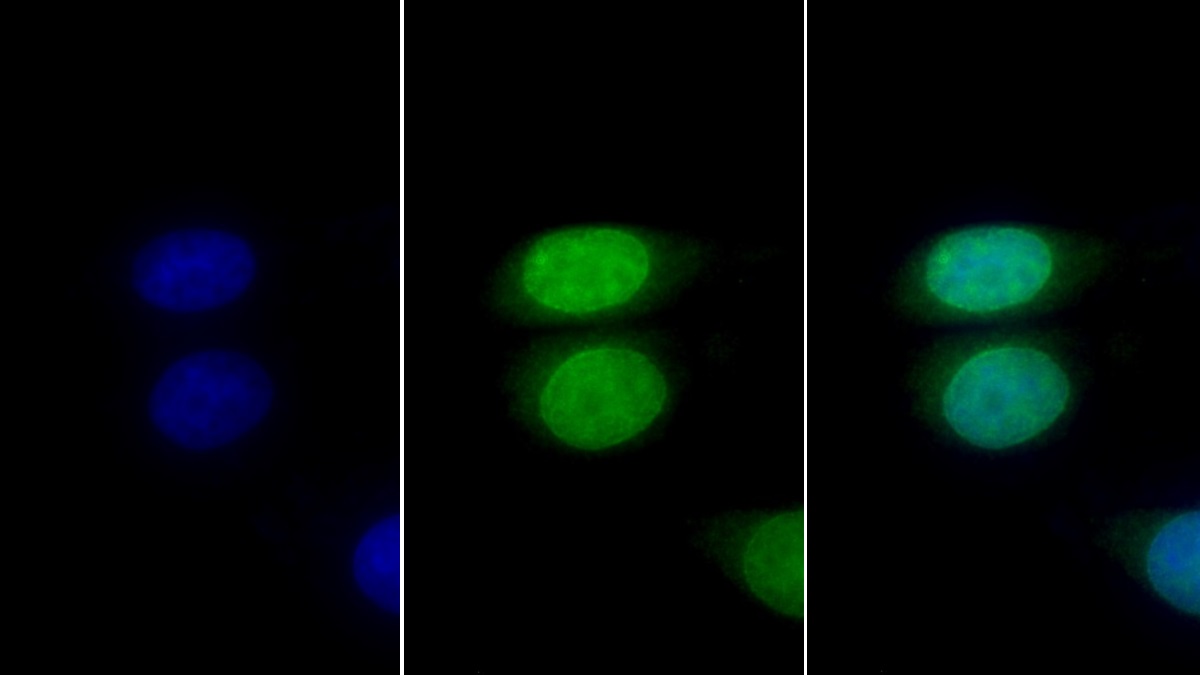 Monoclonal Antibody to Lamin B1 (LMNB1)