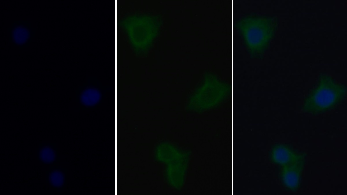 Monoclonal Antibody to Phosphatase And Tensin Homolog (PTEN)