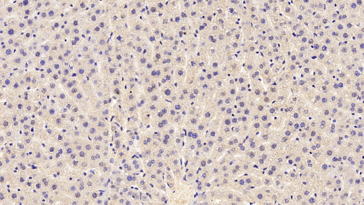 Monoclonal Antibody to Transient Receptor Potential Cation Channel Subfamily M, Member 4 (TRPM4)