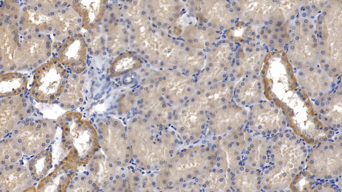 Monoclonal Antibody to ATPase, Na+/K+ Transporting Alpha 1 Polypeptide (ATP1a1)