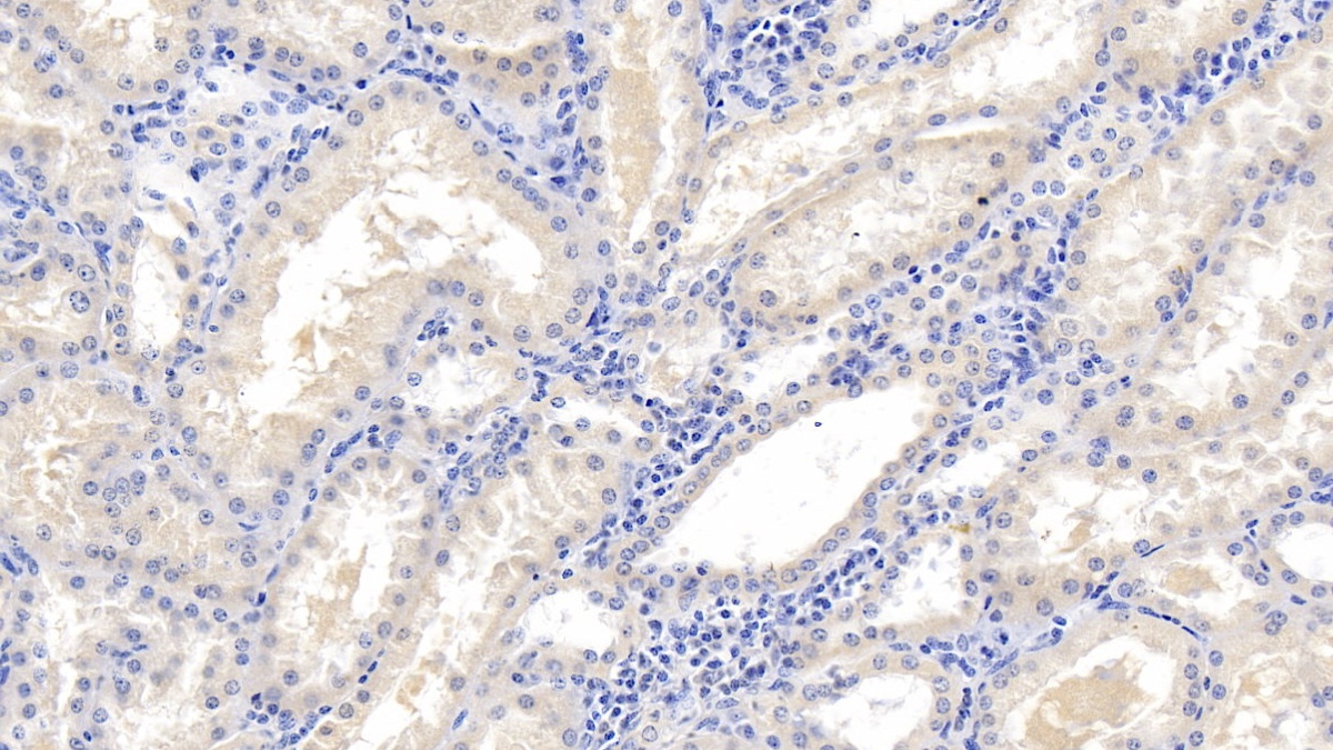 Monoclonal Antibody to Microtubule Associated Protein RP/EB Family, Member 1 (MAPRE1)