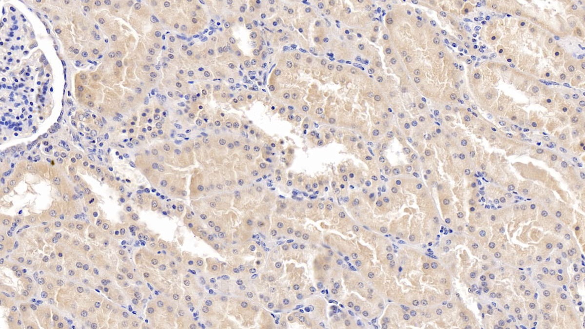 Monoclonal Antibody to Microtubule Associated Protein RP/EB Family, Member 1 (MAPRE1)