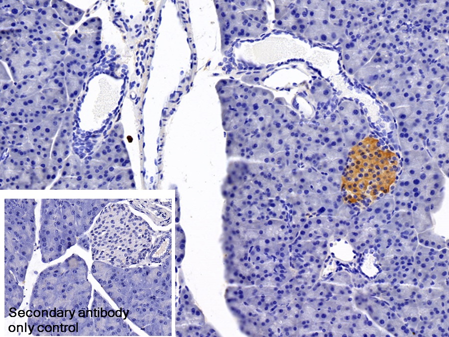 Monoclonal Antibody to Transcobalamin II, Macrocytic Anemia (TCN2)