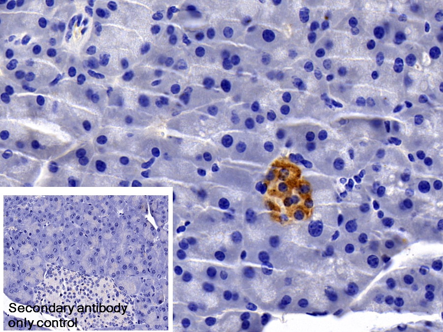 Monoclonal Antibody to Transcobalamin II, Macrocytic Anemia (TCN2)