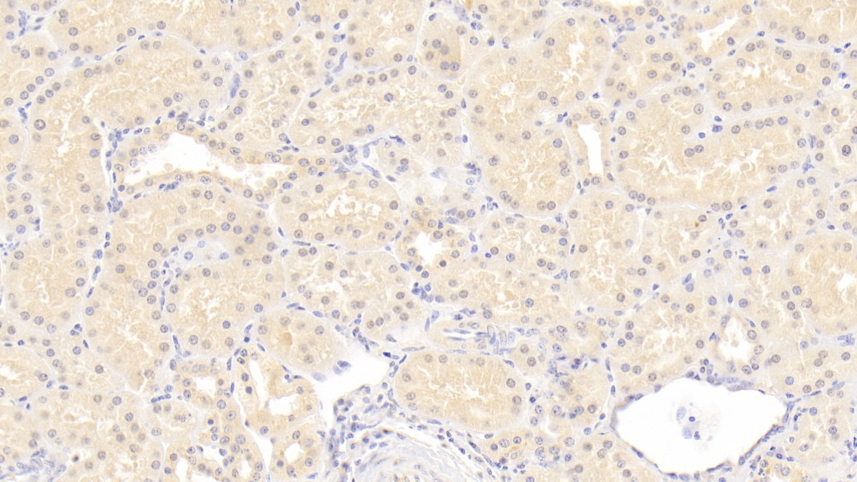 Monoclonal Antibody to Immunoglobulin Superfamily Containing Leucine Rich Repeat Protein (ISLR)