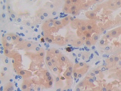 Monoclonal Antibody to Isocitrate Dehydrogenase 1, Soluble (IDH1)