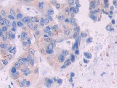 Monoclonal Antibody to Isocitrate Dehydrogenase 1, Soluble (IDH1)