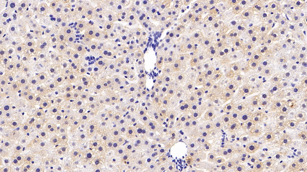 Monoclonal Antibody to Catechol-O-Methyltransferase (COMT)