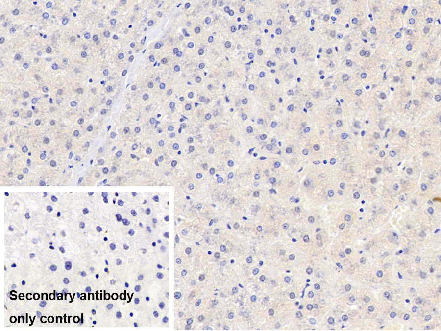 Monoclonal Antibody to Lecithin Cholesterol Acyltransferase (LCAT)